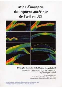 Atlas d'imagerie du segment anteriueur de loeil en OCT