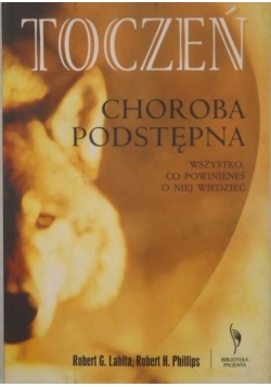 Toczeń choroba podstępna