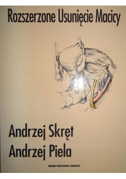 Rozszerzone Usunięcie Macicy