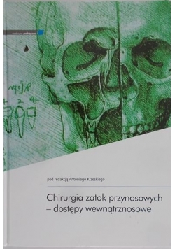Chirurgia zatok przynosowych – dostępy wewnątrznosowe