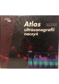 Atlas ultrasonografii naczyń plus CD