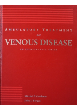 Ambulatory Treatment of Venous Disease