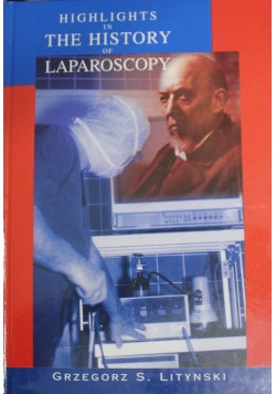 Highlights in the history of laparoscopy