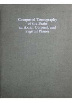 Computed Tomography of the Brain