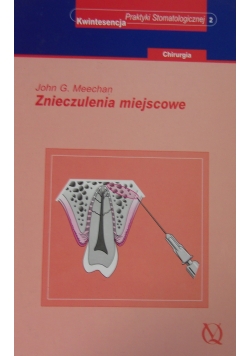 Znieczulenie miejscowe