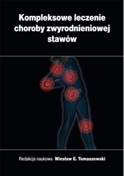 Kompleksowe Leczenie Choroby Zwyrodnieniowej Stawów NOWA