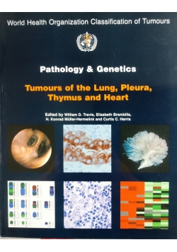 Tumours of the Lung Pleura Thymus and Heart