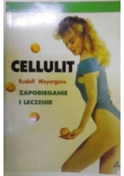 Cellulit, zapobieganie i leczenie