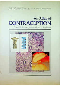 An Atlas of Contraception