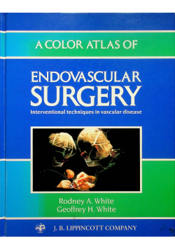 Endovascular sugery