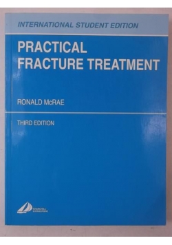Practical Fracture Treatment