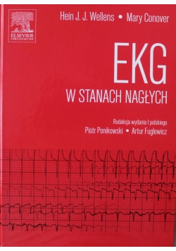 EKG w stanach nagłych