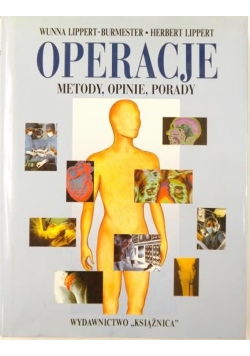 Operacje: Metody, opinie, porady