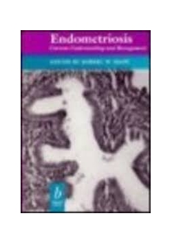 Endometriosis: Current Understanding and Management