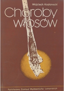 Choroby włosów