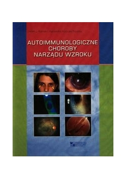 Autoimmunologiczne choroby narządu wzroku, Nowa