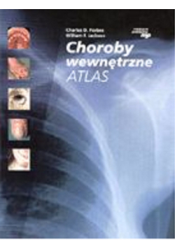 Choroby wewnętrzne  atlas