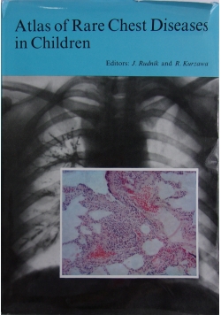 Atlas of rare chest diseases in children