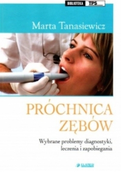 Próchnica zębów wybrane problemy diagnostyki, leczenia i zapobiegania