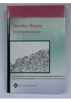 Bladder Biopsy Interpretation