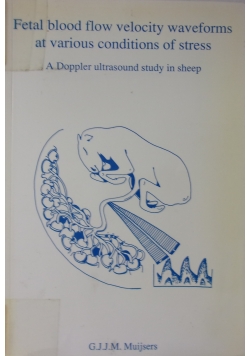 Fetal blood flow velocity waveforms at various conditions of stress. A Doppler ultrasound study in sheep